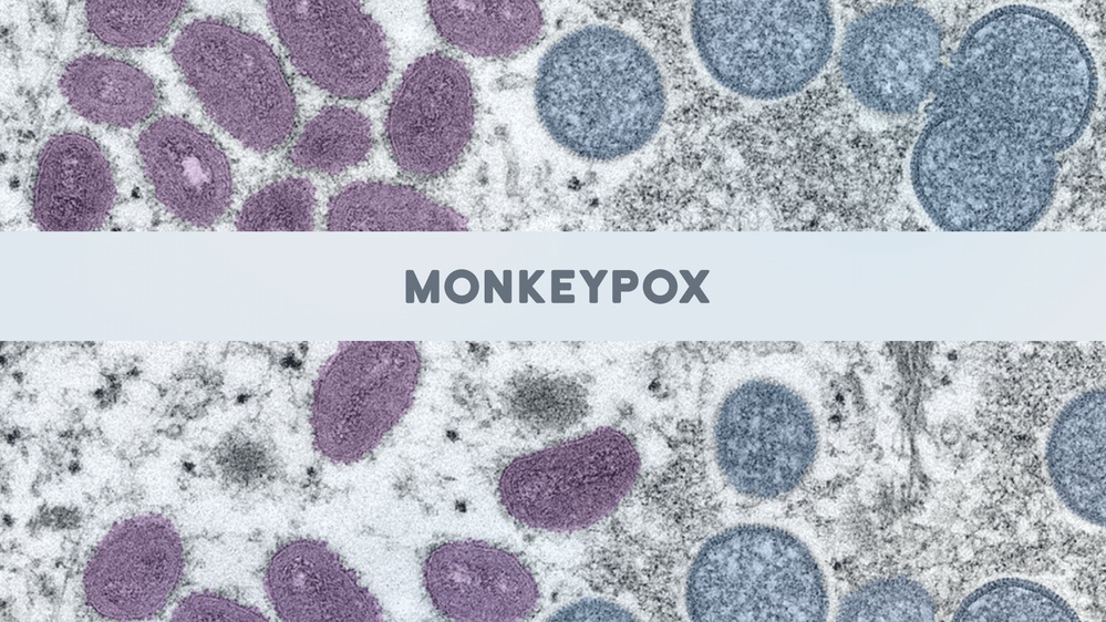 MONKEYPOX