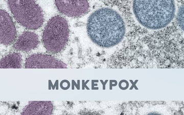 MONKEYPOX