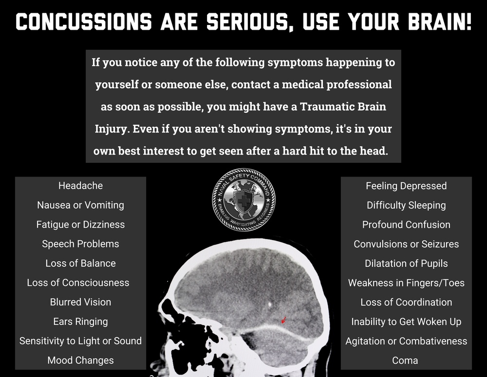 Concussions are serious, use your brain!