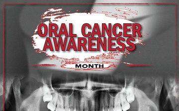 April - Oral Cancer Awareness Month