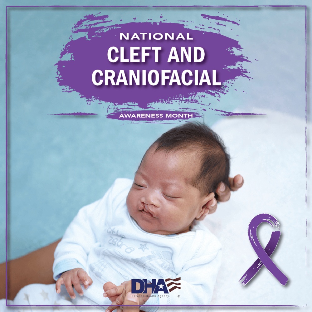 July National Cleft And Craniofacial Month