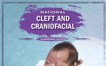 July National Cleft And Craniofacial Month