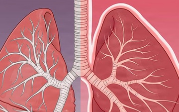 Infographic of JSTO in the News  Article  - Respiratory Reinforcements