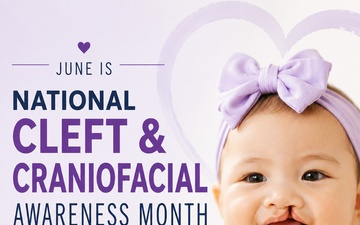 National Cleft and Craniofacial Awareness and Prevention Month