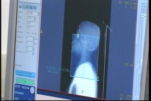 Balad CT Scanner