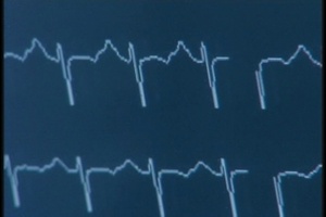 Operation Good Heart