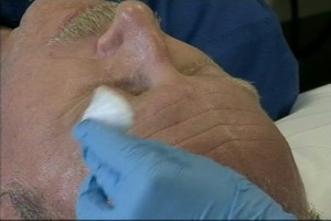 Air Force Report: BOTOX