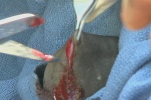 U.S. Soldiers Provide Parasite Control and Remove Tumor from a Cow