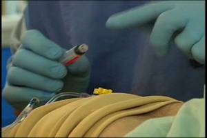 Emergency Surgery - Package, Short Version
