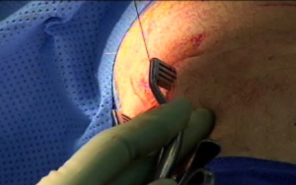 Emergency Surgery