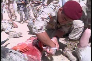 Iraqis Treat Mass Casualties, Package