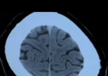 Freedom File: Radiology at FOB Salerno Hospital, Sept. 17