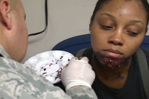Exercise Moulage Artists