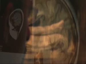 All Hands Update: MRI