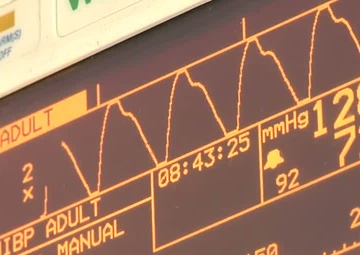 Immediate Response 2012 (2CR MEDICS HELP ALBANIAN SOLDIER)