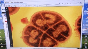 Superhero bug could wipe out deadly diseases