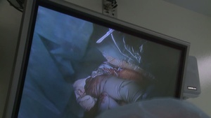 All Hands Update: NMC San Diego's First Ex Utero IntraPartum Treatment