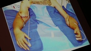 Commandant Helps Soldier Receive Arm Transplants