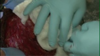 NTC Rotation 12-08-Mass Casualty