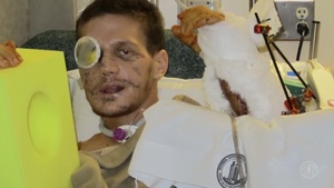 Medal of Honor recipient Kyle Carpenter’s medical recovery