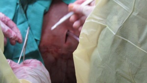 B-Roll of Cut Suit at Fort Belvoir Community Hospital