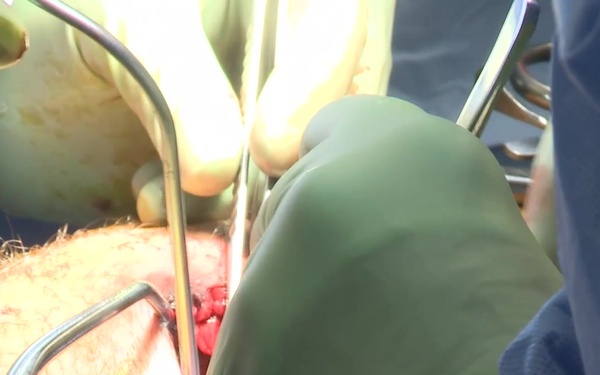 Trauma Surgery B-roll