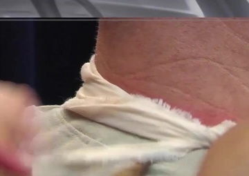 The Immobilization of a Long Bone Injury