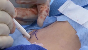 The State of Air Force Medicine: An Interview with the Air Force Surgeon General