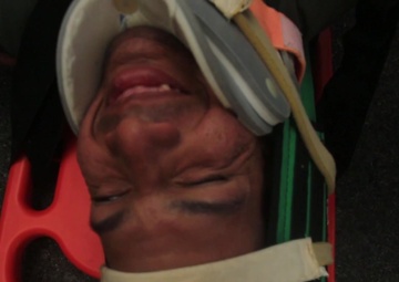 Balikatan 18: Emergency Response