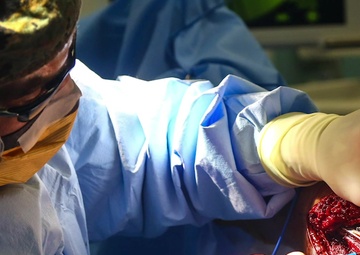 Surgeons Aboard USNS Comfort Perform Surgery to Repair a Patients Femur