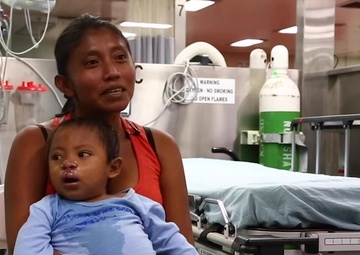 Surgeons Aboard USNS Comfort Perform a Cleft Lip Surgery on a Young Patient