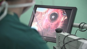 Cataract Surgeries New Horizons 2019