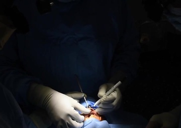 Providing Comfort: Fixing a Cleft Palate