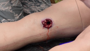 Tactical Combat Casualty Care