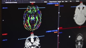 NMCSD National Radiologic Technology Week - PACS