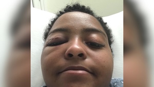 A Marine's Fight for Her Life and Career