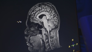 NMRTC San Diego Brain Injury Awareness Month Video