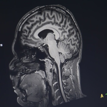 NMRTC San Diego Brain Injury Awareness Month Video