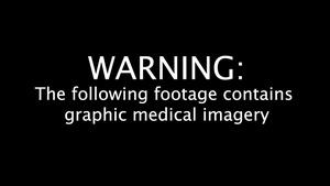 Pacific Partnership 2023: Hysterectomy B-Roll