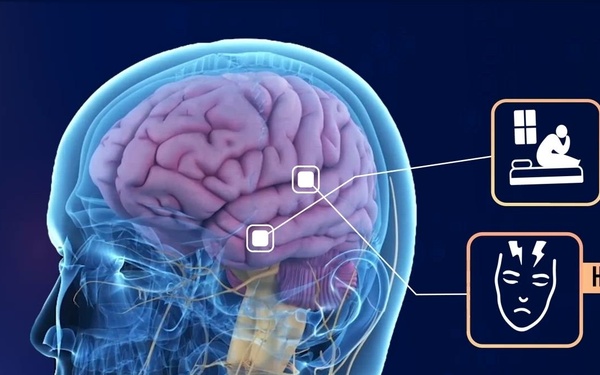 What Are TBI Symptoms?