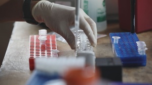 Broll: Walter Reed microbiologist demonstrates rapid field-testing technology during Justified Accord 2026