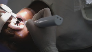 B-Roll:  US, Ghana treat dental patients during AL26 MEDREX
