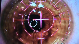 Warrior Refractive Eye Surgery Project (PRK)