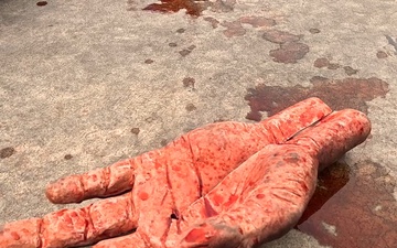 B-Roll: Angola MEDREX fosters combined medical readiness during trauma activation simulation