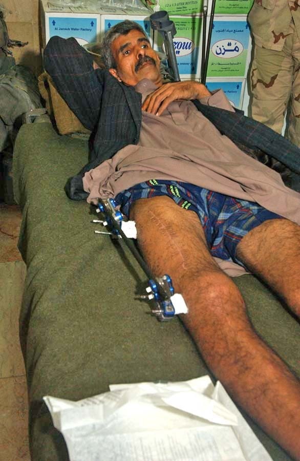 Kadaam Hassoun lies on the operating table