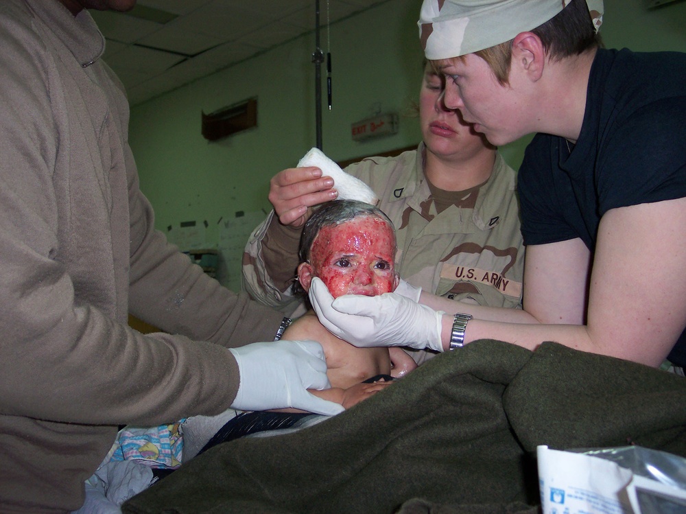 Spc. Stough holds up the head of an 18-month-old girl
