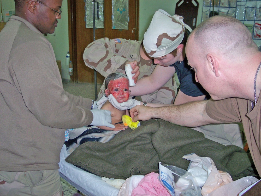 Soldiers treat an 18-monh-old girl who was badly burned