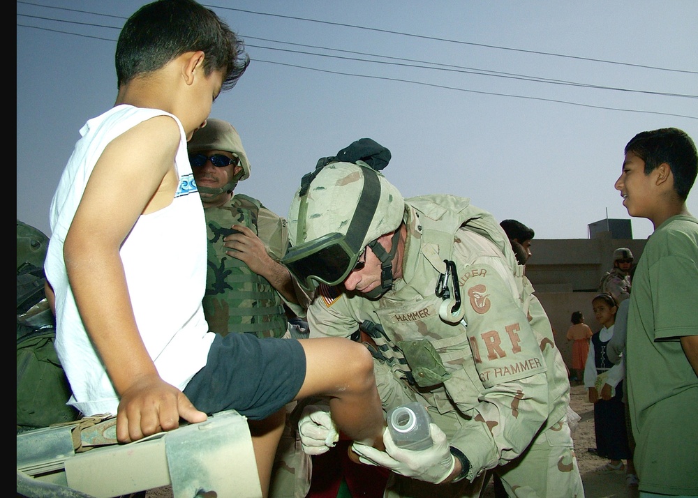Sgt. Kevin J. Hammer treats a child with a severe burn