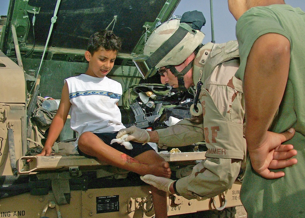 Sgt. Kevin J. Hammer treats a child with a severe burn