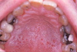 Improve your health by kicking the habit